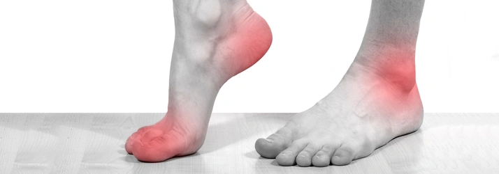Close-up of two feet with red highlighted areas on the heel and ankle